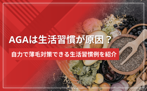 AGAは生活習慣が原因？自力で薄毛対策できる生活習慣例を紹介