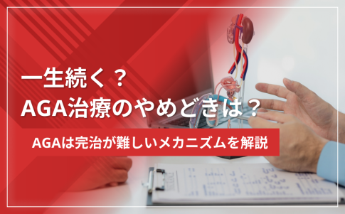 【一生続く？】AGA治療のやめどきは？AGAは完治が難しいメカニズムを解説