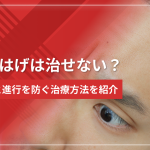 【手遅れ？】M字はげは治せない？原因と進行を防ぐ治療方法を紹介