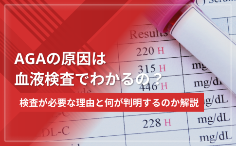 AGAの原因は血液検査でわかるの？検査が必要な理由と何が判明するのか解説