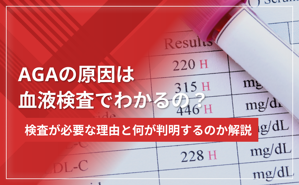 AGAの原因は血液検査でわかるの？検査が必要な理由と何が判明するのか解説