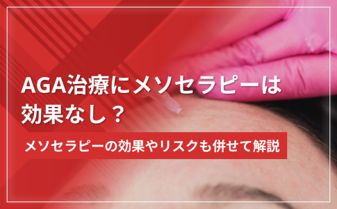 AGA治療にメソセラピーは効果なし？メソセラピーの効果やリスクも併せて解説