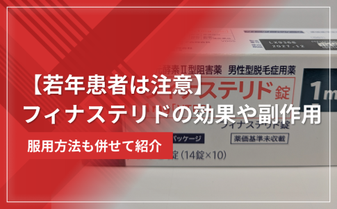 【若年患者は注意】フィナステリドの効果や副作用・服用方法を紹介