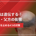ハゲは遺伝する?母方・父方の影響と薄毛を止める4つの対策