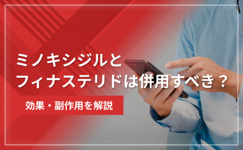ミノキシジルとフィナステリドは併用すべき？効果・副作用を解説