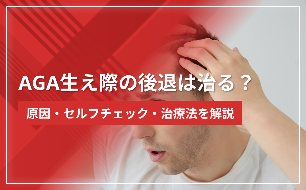 AGA生え際の後退は治る？原因・セルフチェック・治療法を解説