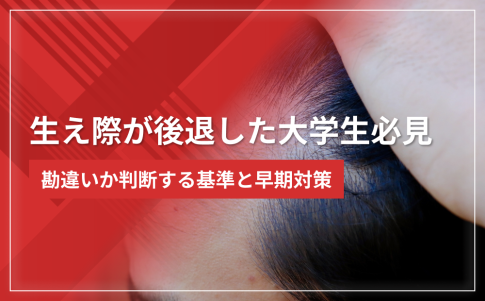 生え際が後退した大学生必見｜勘違いか判断する基準と早期対策
