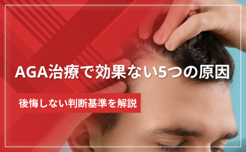 AGA治療で効果ない人に多い5つの原因と後悔しない判断基準
