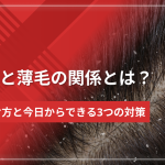フケと薄毛の関係とは？原因の見分け方と今日からできる3つの対策